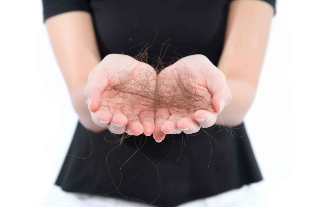 Hair Loss treatmnet in US